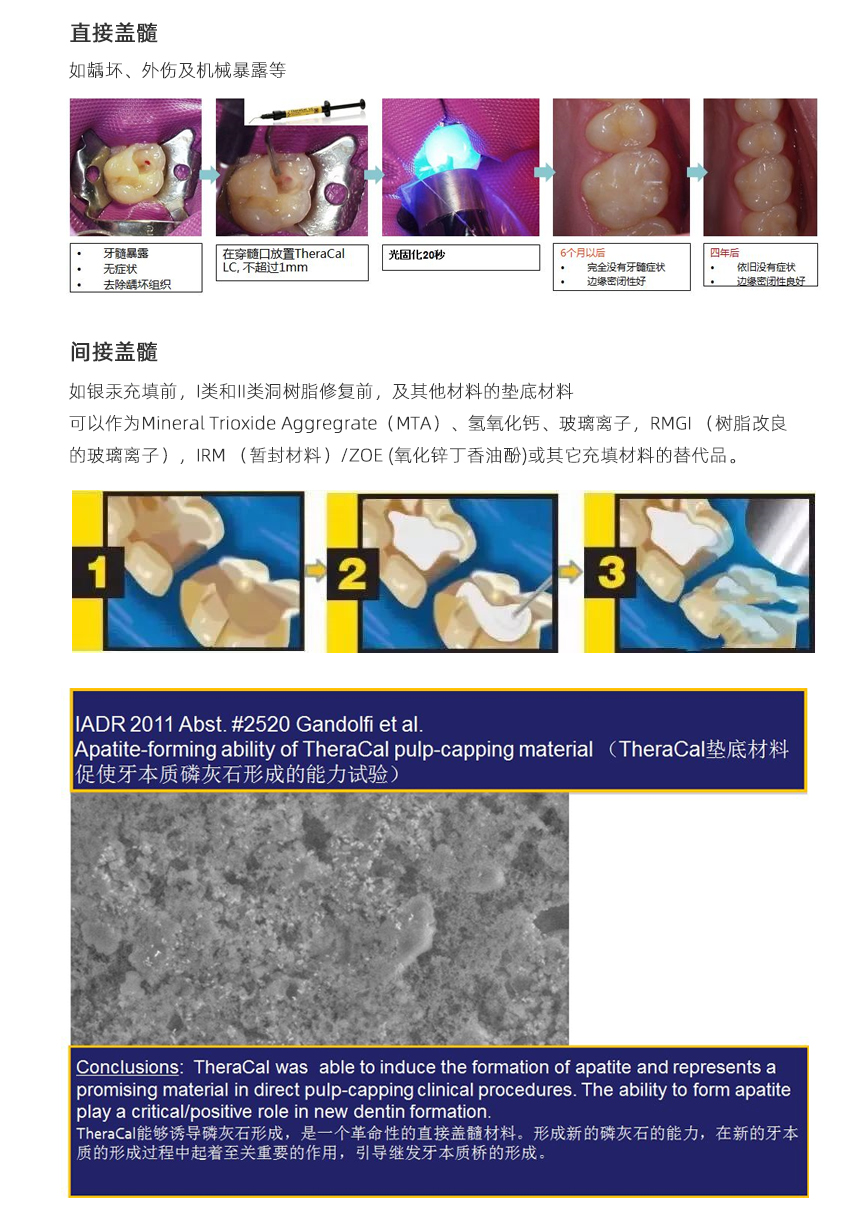 光固化垫底材料_02.jpg