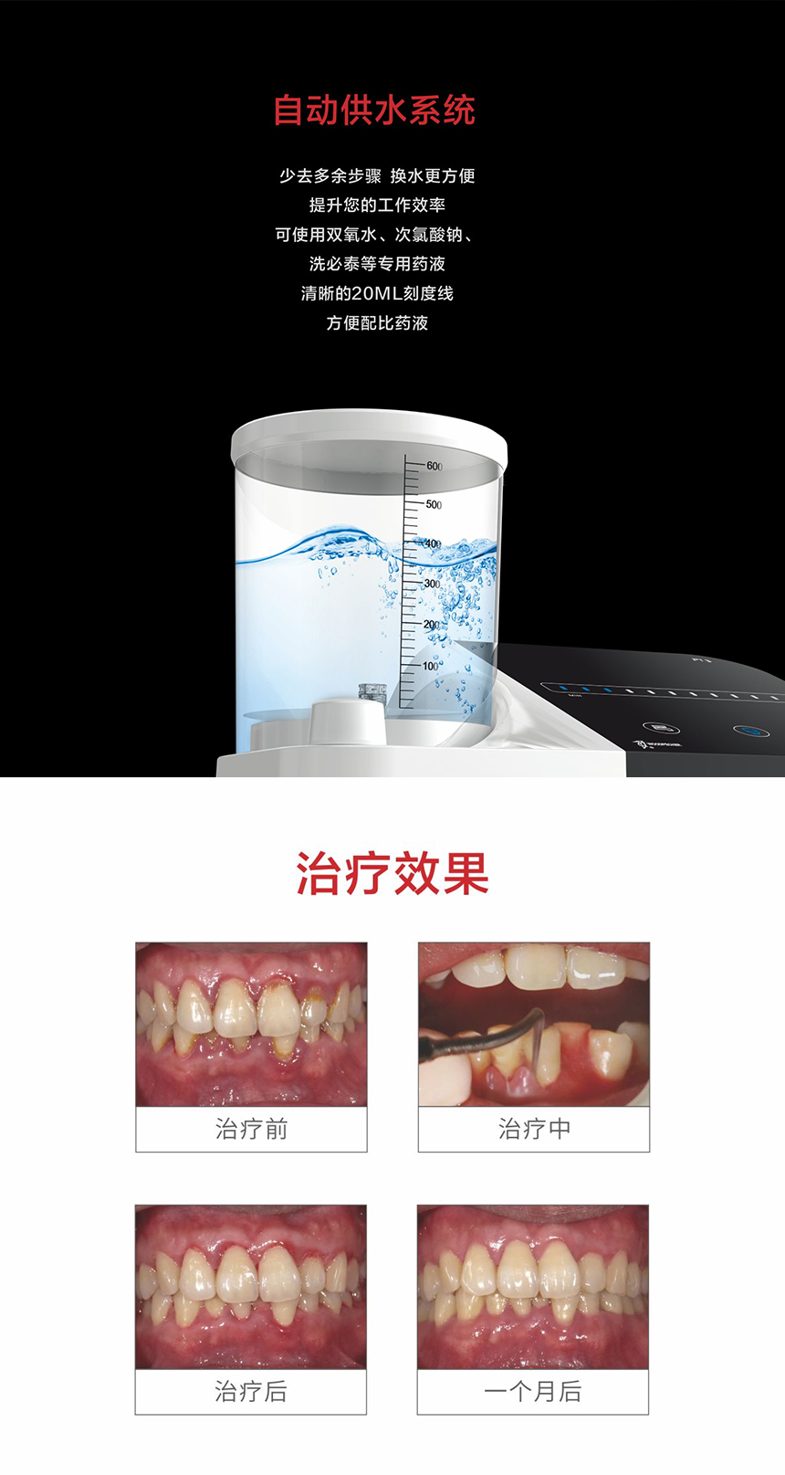 牙周治疗仪_05.jpg