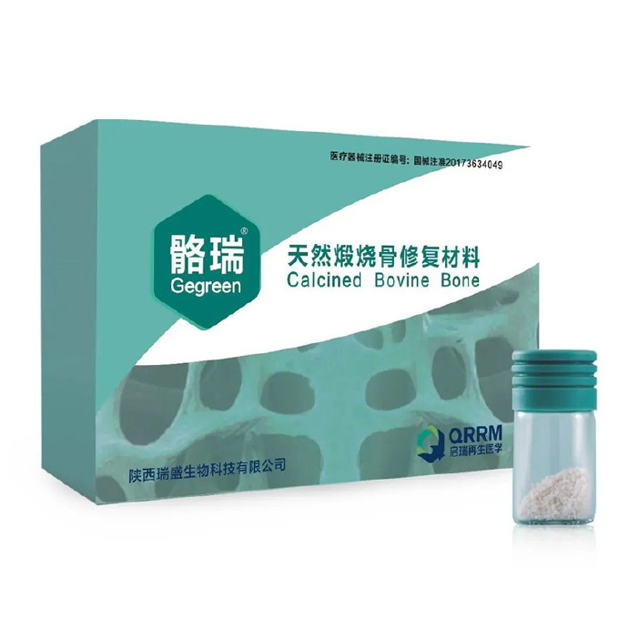 骼瑞 骨粉 天然煅烧骨修复材料